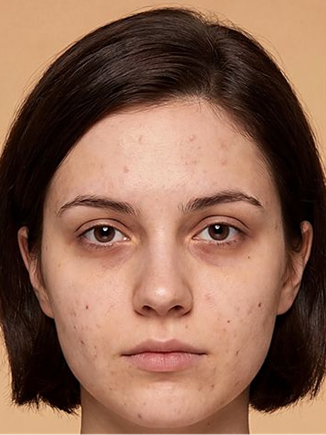 Before: bare skin with blemishes and dark circles
